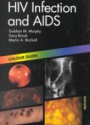 HIV Infection and AIDS