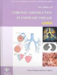 Hansel T. - Atlas of Chronic Obstructive Pulmonary Disease COPD
