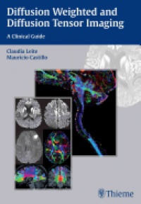 Claudia Leite,Mauricio Castillo - Diffusion Weighted and Diffusion Tensor Imaging: A Clinical Guide: A Clinical Guide