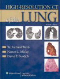 Webb W. - High - Resolution CT of the Lung, 4th ed.
