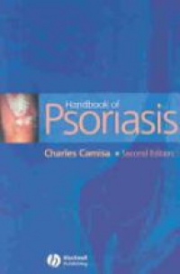 Camisa Ch. - Handbook of Psoriasis