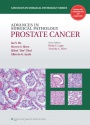 Advances in Surgical Pathology: Prostate Cancer