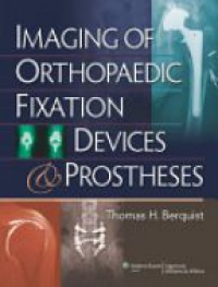 Berquist T. - Imaging of Orthopaedic Fixation Devices and Prostheses