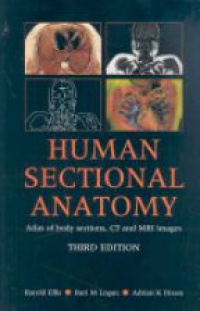 Harold Ellis,Bari M Logan,Adrian K. Dixon - Human Sectional Anatomy: Atlas of Body Sections, CT and MRI Images