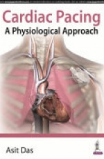 Cardiac Pacing A Physiological Approach
