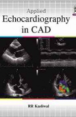 Applied Echocardiography in CAD