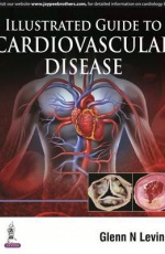 Illustrated Guide to Cardiovascular Disease