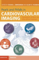 Pearls and Pitfalls in Cardiovascular Imaging: Pseudolesions, Artifacts, and Other Difficult Diagnoses