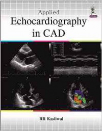 RR Kasliwal - Applied Echocardiography in CAD