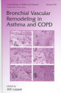 Aili Lazaar - Bronchial Vascular Remodeling in Asthma and COPD