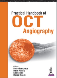 Bruno Lumbroso, David Huang, Eric Souied, Marco Rispoli - Practical Handbook of OCT Angiography