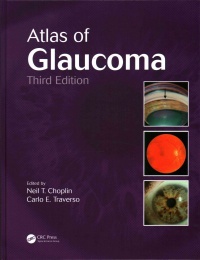Neil T. Choplin, Carlo E. Traverso - Atlas of Glaucoma
