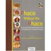 Carmona F. - Phaco without the Phaco ECCE and Manual Small-Incision Techniques for Cataract Surgery