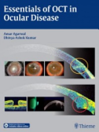 Amar Agarwal,Dhivya Ashok Kumar - Essentials of OCT in Ocular Disease