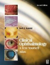 Kanski J. J. - Clinical Ophthalmology A Test Yourself Atlas