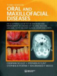 Crispian Scully,Stephen R. Flint,Stephen R. Porter,Kursheed F. Moos - Oral and Maxillofacial Diseases: An Illustrated Guide to Diagnosis and Management of Diseases of the Oral Mucosa, Gingivae, Teeth, Salivary Glands, Bones and Joints