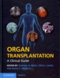 Klein A. A. - Organ Transplantation: A Clinical Guide