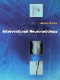 Byrne J. - Interventional Neuroradiology: Theory and Practice