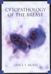 Mckee G. T. - Cytopathology of the Breast: With Imaging and Histologic Correlation