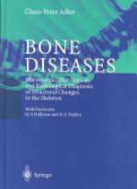 Adler C. - Bone Diseases,    Macroscopic, Histological and Radiological Diagnosis