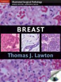 Lawton T. - Breast