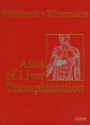 Atlas of Liver Transplantation