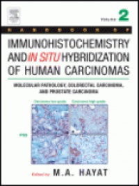 Hayat M. - HNDB of Immunohistochemistry and in Situ Hybridization of Human Carcinomas Vol. II