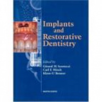 Scortecci G. M. - Implants and Restorative Dentistry
