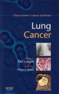 Lorigan P. - Lung cancer