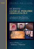 Hurwitz Cilincal Pediatric Dermatology: A Textbook of Skin Disorders of Childhood and Adolescence