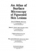 An Atlas of Surface Microscopy of Pigmented Skin Lesions
