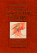 Complications of Laparoscopic Surgery