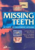 Missing Teeth. A Guide to Treatment Options