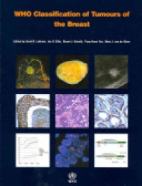 Lakhani - WHO Classification of Tumours of the Breast
