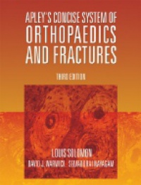 Solomon L. - Apley´s Concise System of Orthopaedics and Fractures