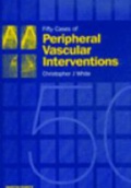 Fifty Cases of  Peripheral Vascular Interventions