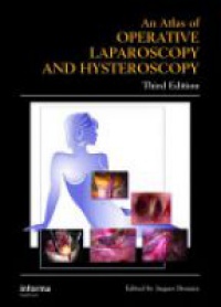 Donnez J. - Atlas of Operative Laparoscopy and Hysteroscopy