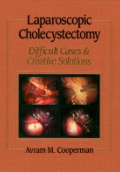 Laparoscopic Cholecystectomy