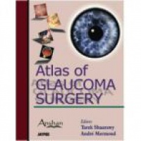 Shaarawy T. - Atlas of Glaucoma Surgery