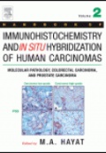 HNDB of Immunohistochemistry and in Situ Hybridization of Human Carcinomas Vol. II