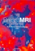 Breast MRI in Practice