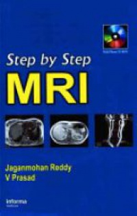 Reddy J. M. - Step by Step MRI