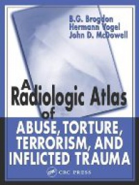 Brogdon B. - Radiologic Atlas of Abuse, Torture Terrorism, and Inflicted Trauma
