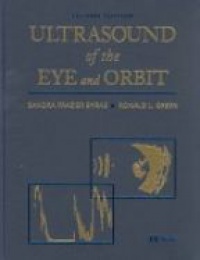 Byrne S. - Ultrasound of the Eye and Orbit