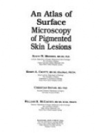 Menziers S. W. - An Atlas of Surface Microscopy of Pigmented Skin Lesions
