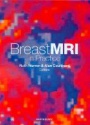Breast MRI in Practice