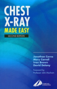 Corne J. - Chest X-ray Made Easy