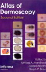 An Atlas of Dermoscopy