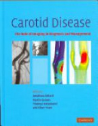 Carotid Disease: The Role of Imaging in Diagnosis and Management ...