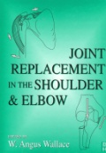 Joint Replacement in the Shoulder & Elbow